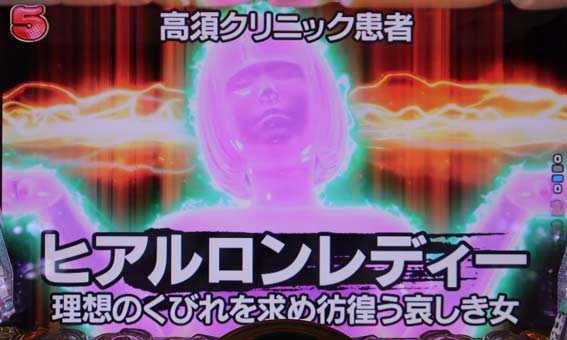 高須クリニック 4500 ヒアルロンレディー